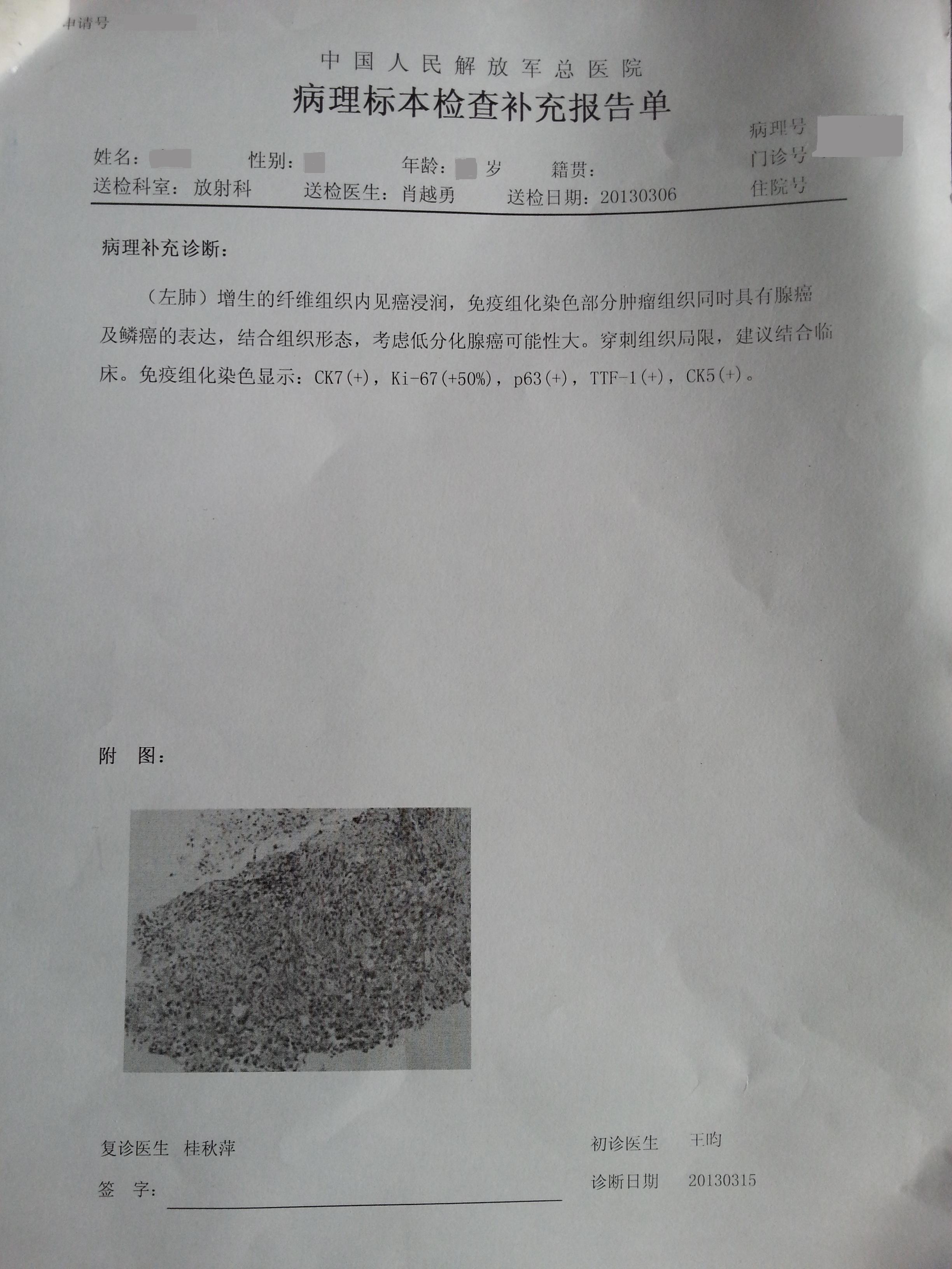 免疫组化：北京301医院  570元