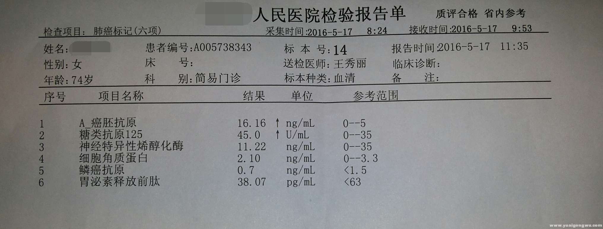 5月17日，肺癌标志物