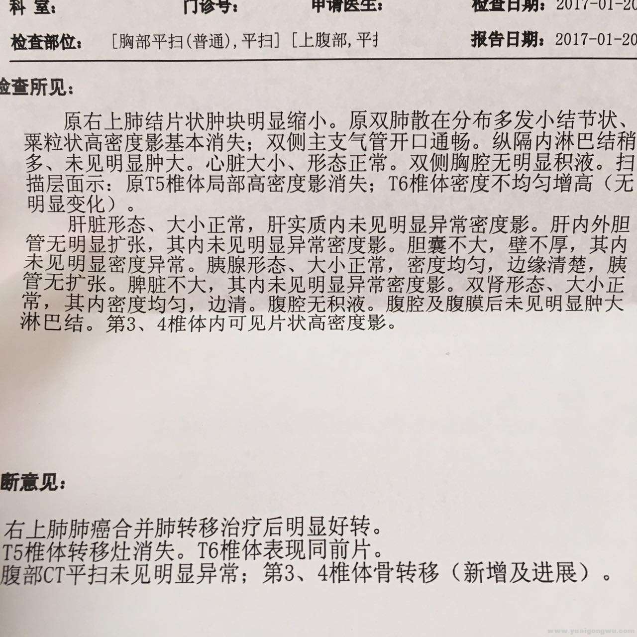 一个月复查的CT报告