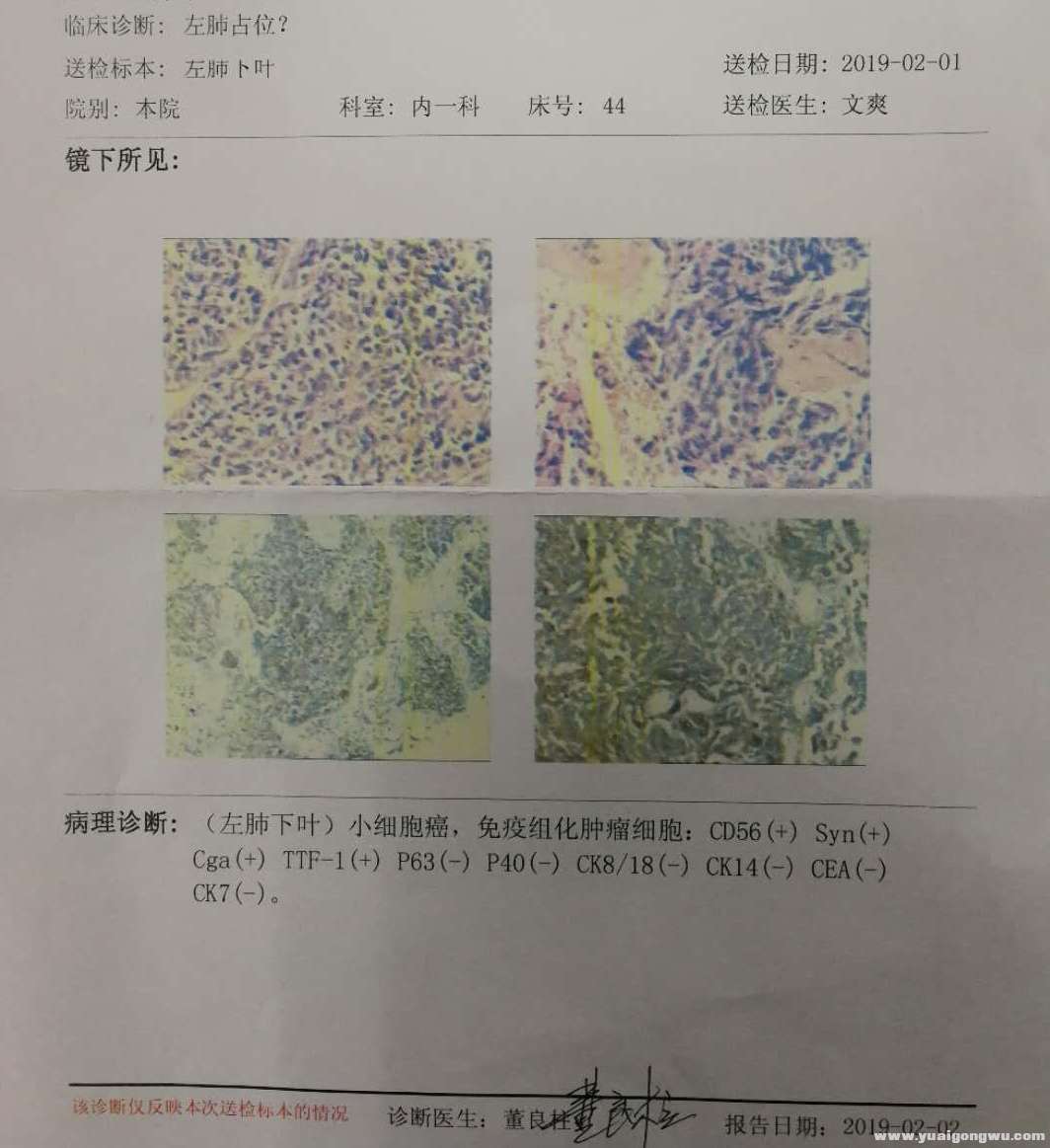 2月15日病理科分型报告单